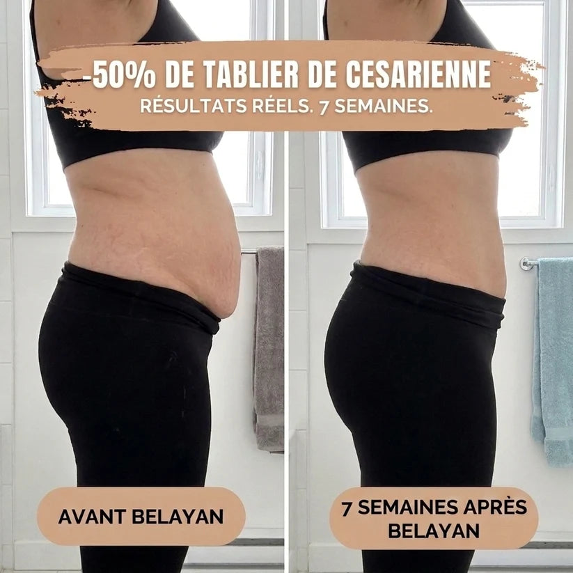 Culotte gainante post-partum à bande croisée 360°